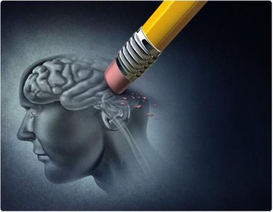 تشخیص آلزایمر با الگوریتم هوش مصنوعی ​